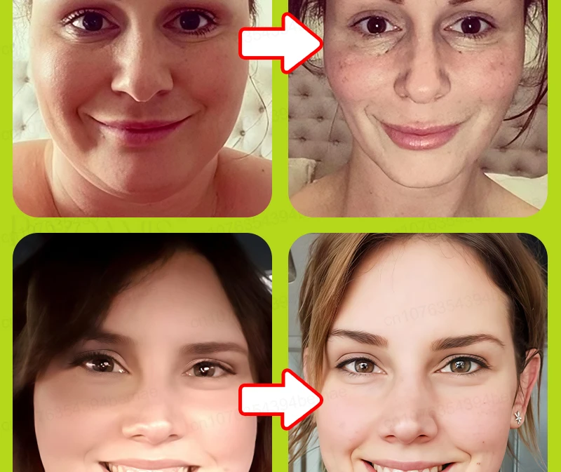 V-face Repair Mask, Eliminates double Chin, improves facial contouring, shaping bandage, quickly slims the face, removes masseter muscle, facial lifting band, anti-aging, deep hydration, creating a V-shaped face.