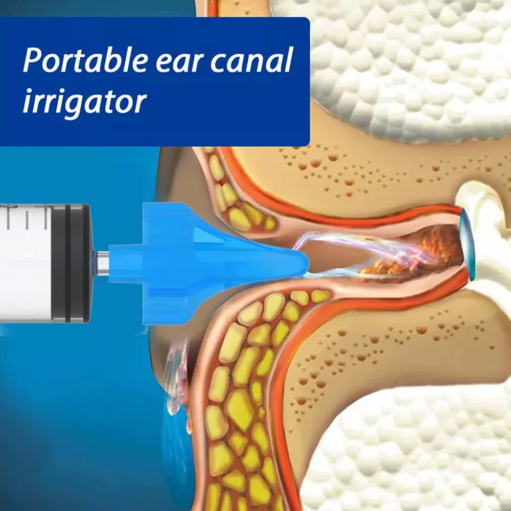 Ear Cleaner Irrigation Kit, Ear Wax Removal Tool, Seringa de Lavagem de Água, Confortável, Único, Ferramentas de Saúde, 10ml, 2Pcs