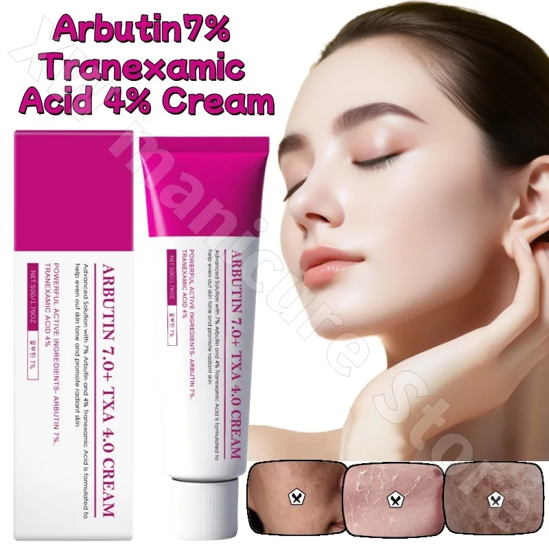 Crema Facial con Arbutina al 7% y Ácido Tranexámico al 4%, Hidratante, Calmante, Reparadora, Iluminadora del Tono de Piel, 50 ml