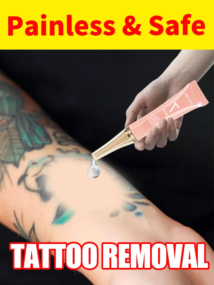

Tattoo Removal Cream Suitable for Large and Small Tattoos Effectively Removes Permanent Tattoos