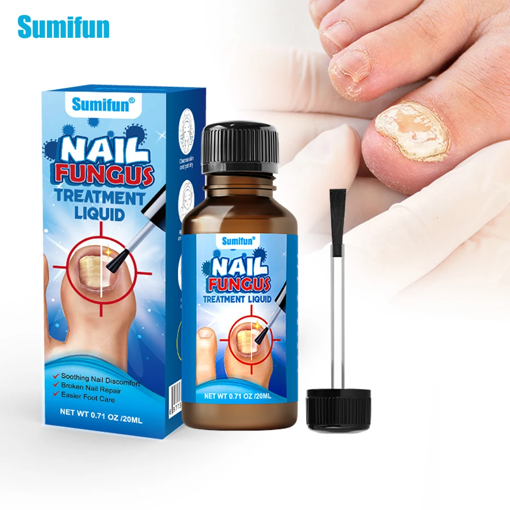 1/2/3Pcs Sumifun Fungal Nail Cream Fungus Removal Anti-Infection Foot Repair Toe Relieve Itching Paronychia Medical Plaster 20ml