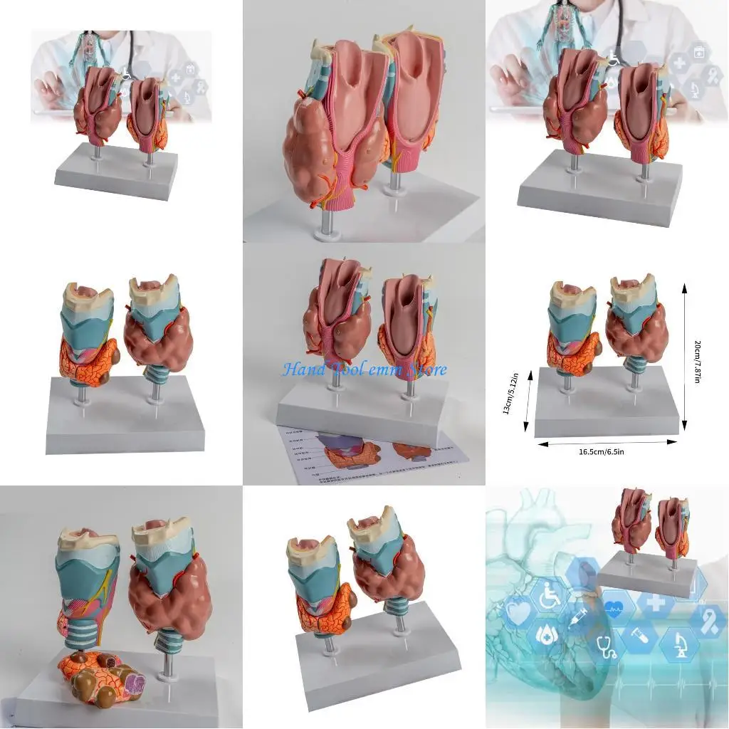 

Модель H37F патологической анатомии щитовидной железы человека для студентов-врачей, анатомическая патологическая модель железы