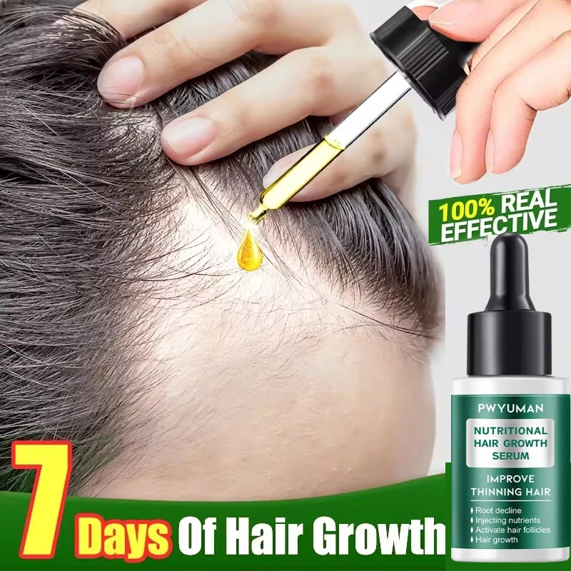 

7-дневная имбирная сыворотка для роста волос, быстрая способность роста волос, средства против выпадения волос, восстановление кожи головы, облысение, питание, уход за корнем волос