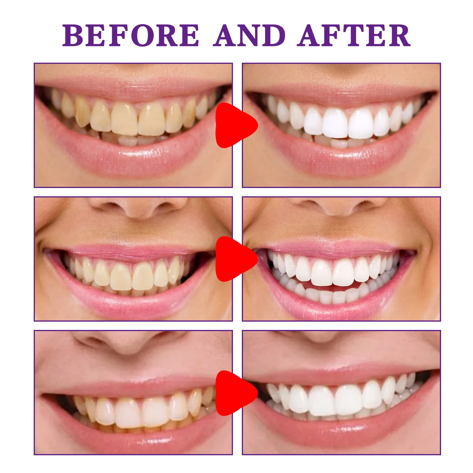 Tandenreiniging Whitening Tand - Teeth Whitening Korea recensie en prijs