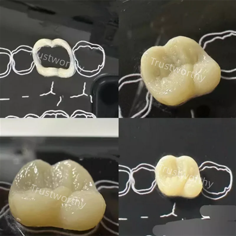 Dentes dentais Morfologia Anatômica Study Board Modelo, Resina Composite Filling Prática, 3 Tamanhos