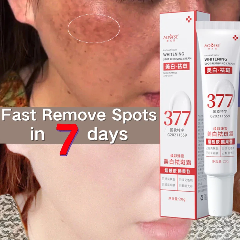 

377 Mild Spot-Removing Whiten Cream Blemish Cream Eliminates Lightens Melanin Dull Pigment Melasma Moisturizes Korean Skin Care