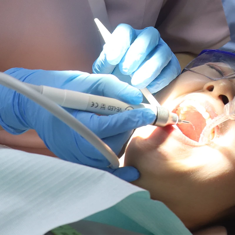 Ultraschall-Scaler Dentalhandstück LED-Kabel für EMS Woodpecker UDS Ultraschall-Piezo-Scaler zur Zahnreinigung Zahnarztwerkzeuge – Detail 2