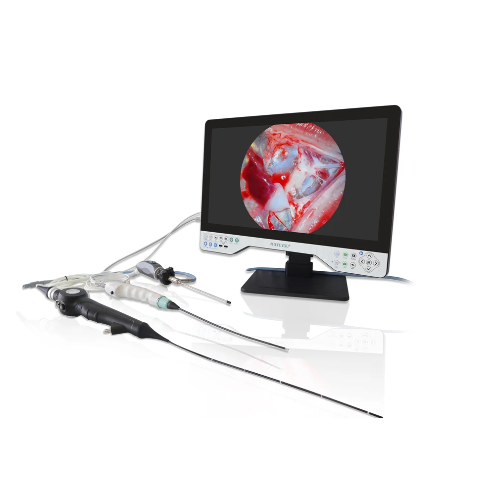 New Compact Video Endoscope ENT Endoscopic Camera Portable for Otolaryngology Rhinoscope Sinuscope Laryngoscope