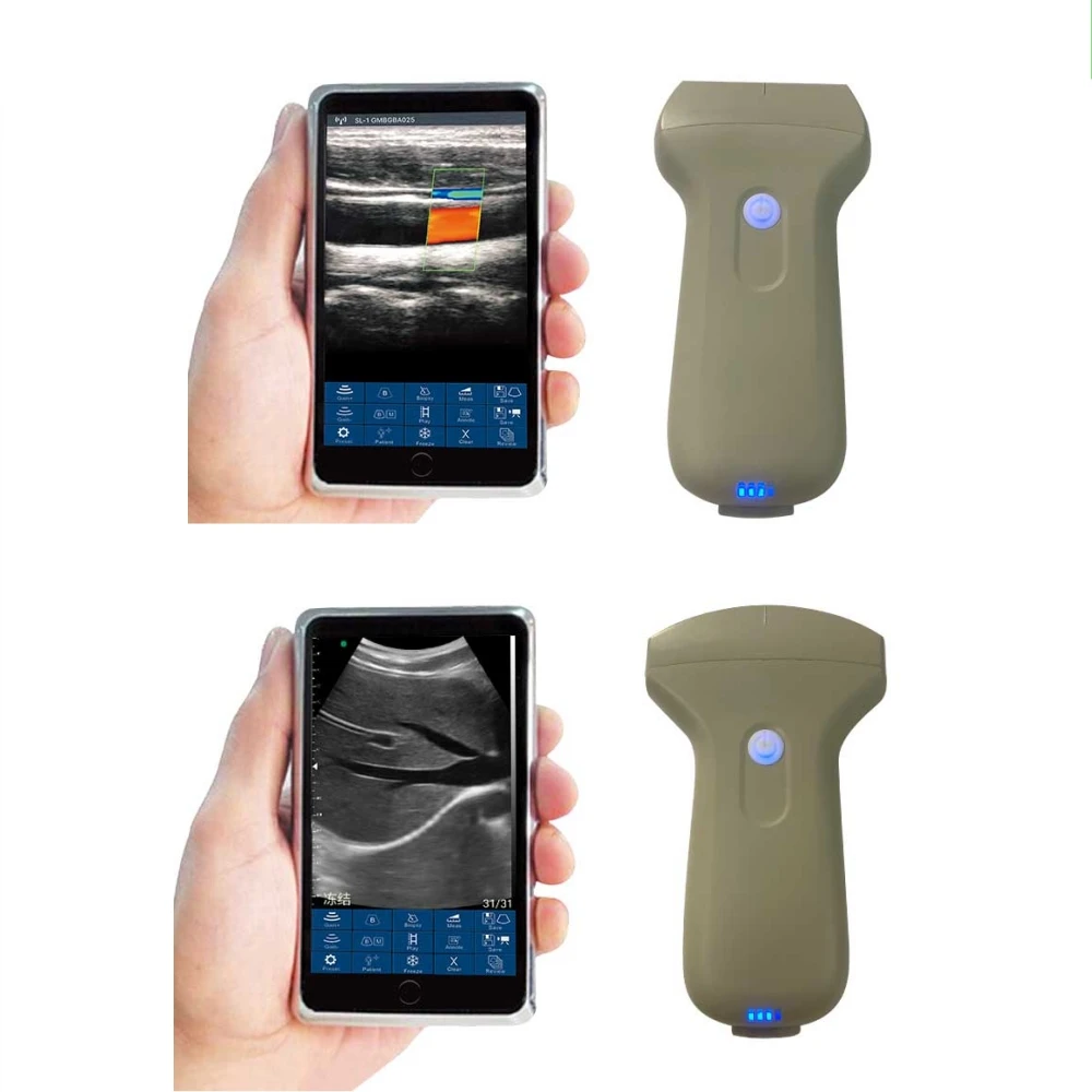 New Wireless USB Color Doppler Ultrasound Scanner Convex Linear Probe for Abdomen Cardiac Kidney Vascular Use