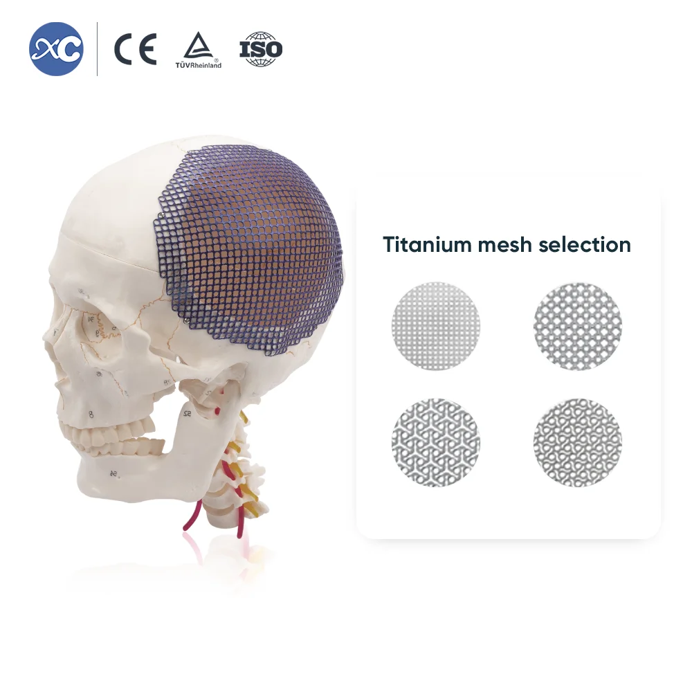 XC Hot Sale Cranial Titanium Mesh  2D Hole Orthopedic & Neurosurgery Class III 1 Year Warranty