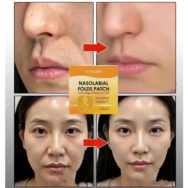 الطيات الأنفية التصحيح تحتوي على الكولاجين حمض الهيالورونيك ثبات الجلد تتلاشى الخطوط الدقيقة ترطيب عميق قناع الوجه المضادة للتجاعيد