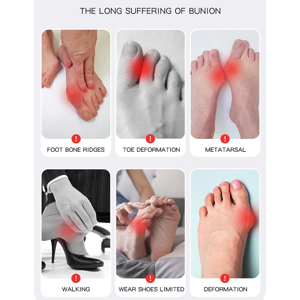 Big Toe Valgus Corrector, Bunion Corrector Relief voor Vrouwen en Mannen, Verstelbare Voeten Bot, Duim Correctie Sokken, 1Pc