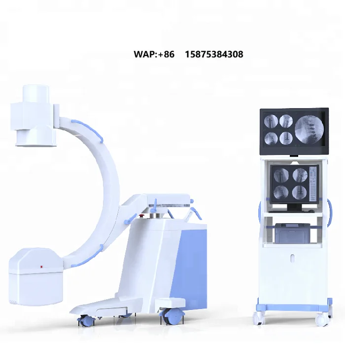 China's 100mA high-frequency mobile digital best doctor c-arm x-ray film, c-arm x-ray machine equipment use price concessions
