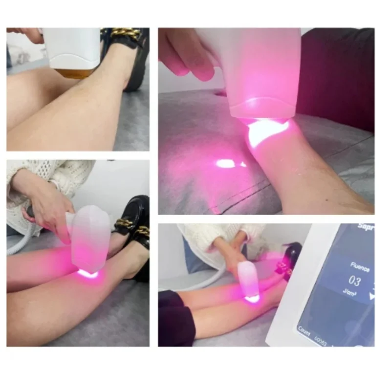 Портативный диодный лазер 808 нм для удаления волос, профессиональная машина для омоложения кожи, титановое безболезненное устройство для постоянной эпиляции