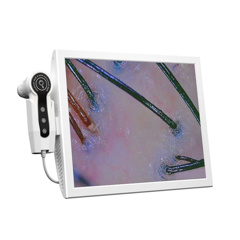 

OEM&ODM Professional Hair Follicles Scalp Scanner Detector Hair Analyzer / Skin and Scalp Hair Analysis Machine