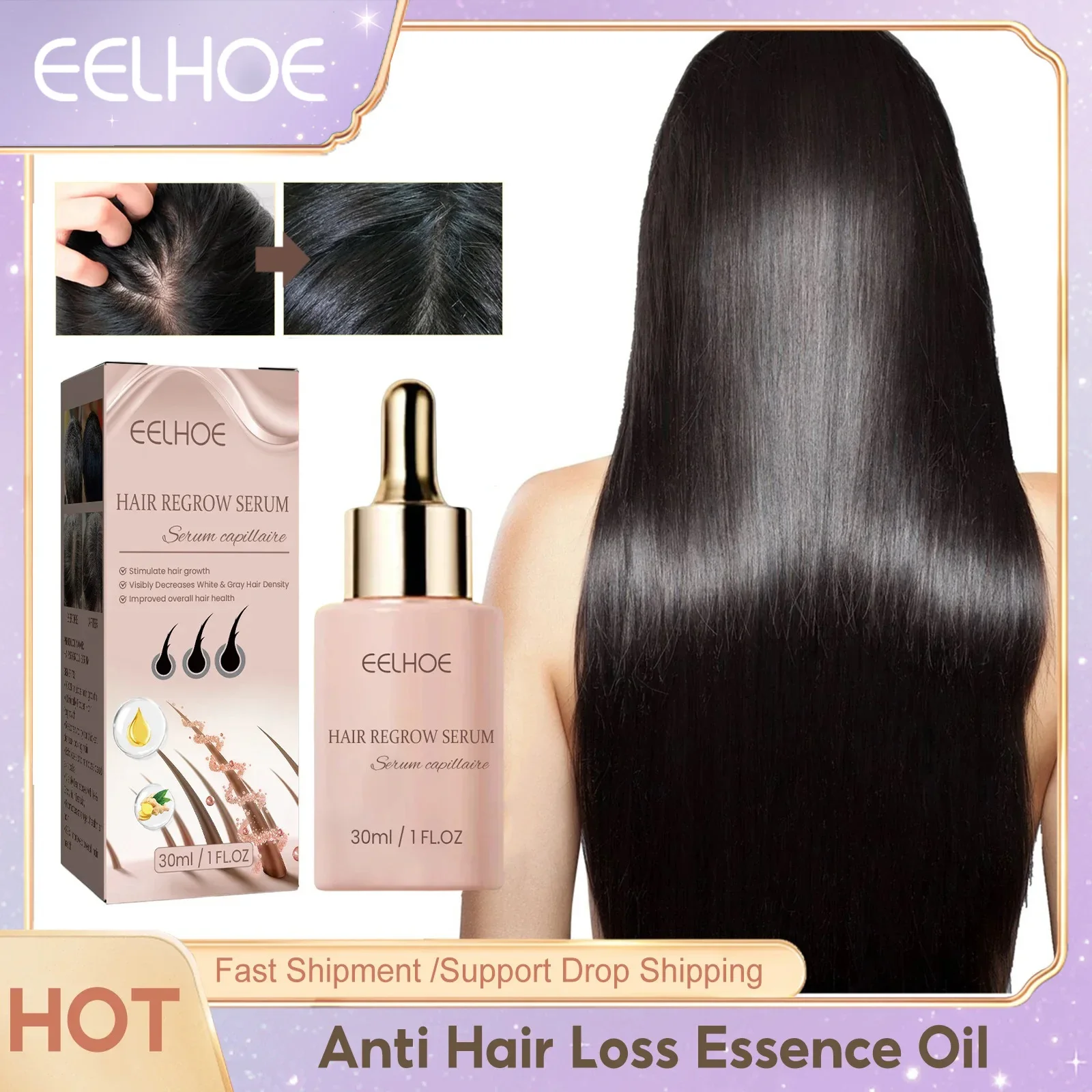 EELHOE Serum pertumbuhan cepat Pria Wanita, minyak Essence akar rambut perbaikan kerusakan kulit kepala, Anti rambut rontok 30ml