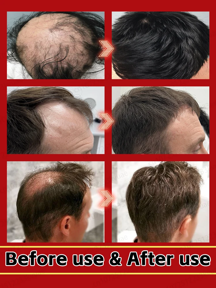 ʰᵃⁱʳ ᵍʳᵒʷᵗʰ ᵉˢˢᵉⁿᶜᵉ Promote rapid hair growth, repair bald spots and say goodbye to baldness.