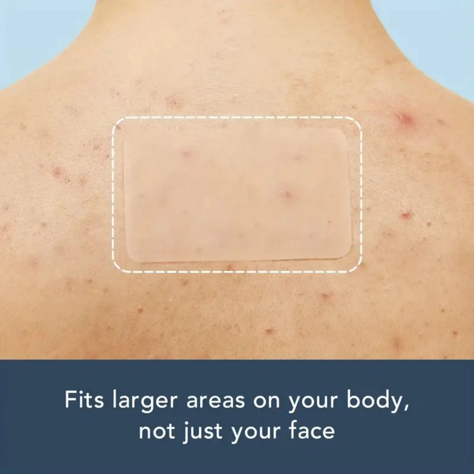 9 قطع من ملصقات حب الشباب غير المرئية، مقاومة للماء وقابلة للتنفس، يتم ارتداؤها خلال 24 ساعة في اليوم، محمولة