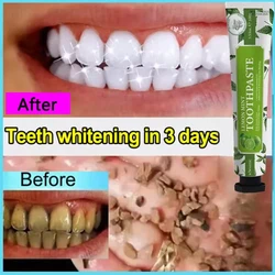 Teeth Whitening Toothpaste Remove Plaque Stains Dental Calculus Oral Hygiene Cleaning Fresh Breath Bleaching Dental Care Tools