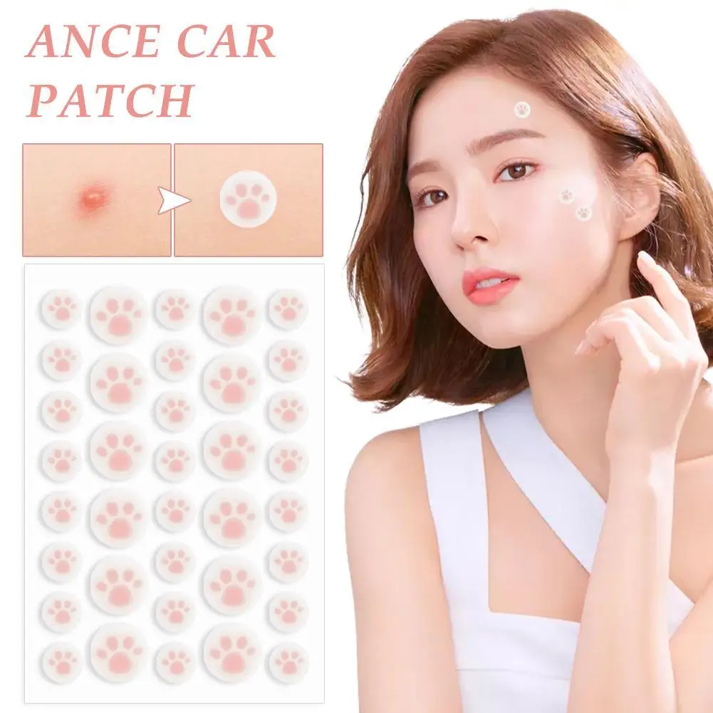 Cat Claw Shape Invisible Acne Remoção, Pimple Patch, Beauty Acne Tools, Corretivo Original, Face Spot Beauty Makeup