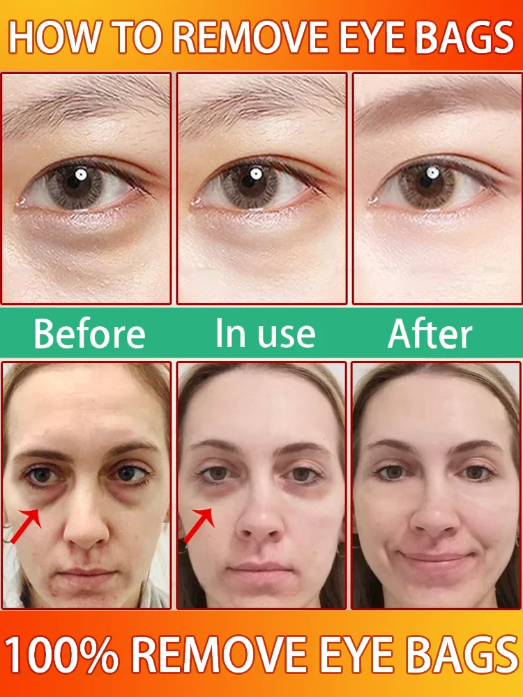 Instant Eye Bag Remover Gel-Cream Erase Bags Under Eyes | Dark Circle Corrector | 7 Days Visible