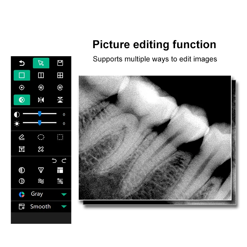 VVDENTAL Portable Dental Sensor Digital radiovisiograph Intraoral Imaging System HD mage，2Years Warranty,Digital X-ray Sensor