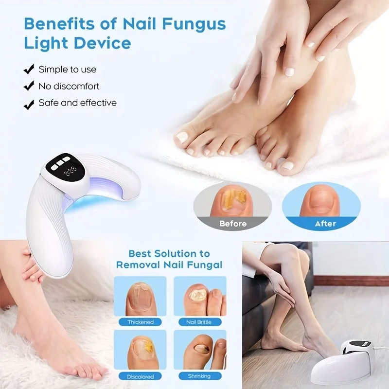 

1/2/4 Pcs Nail Fungus Light Device for Toenails and Fingernails