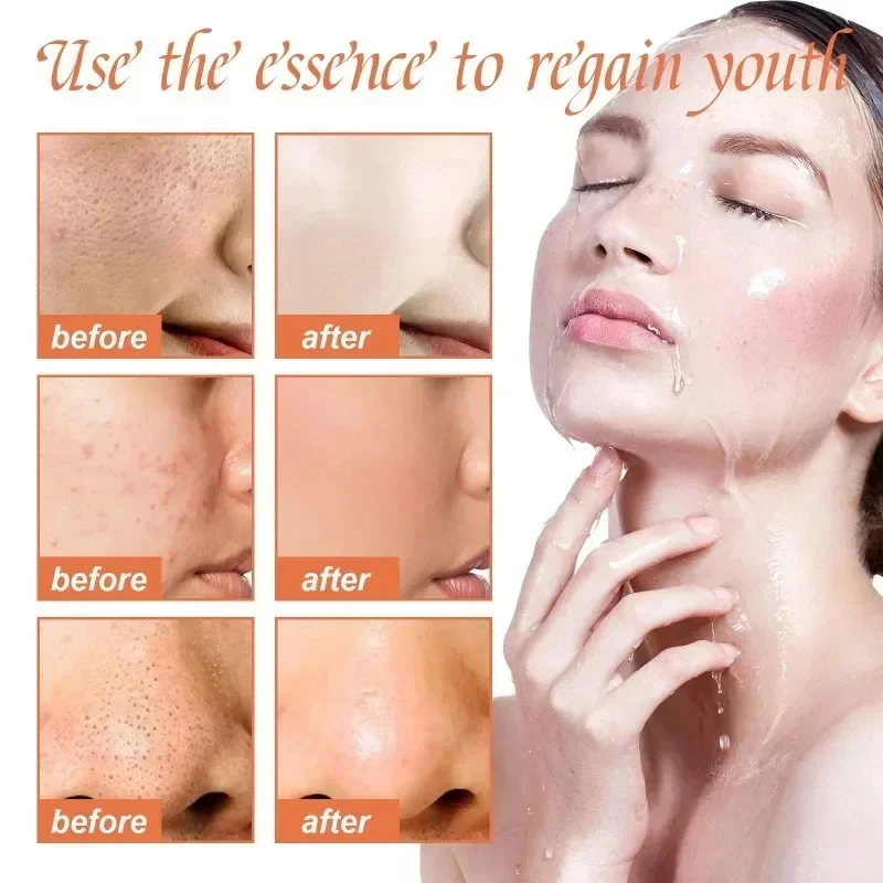 Pore Shrinking Serum Face Removing Large Pores Tightening Repairing Facial Pore Minimizing Essence Get Rid of Acne Marks 2024