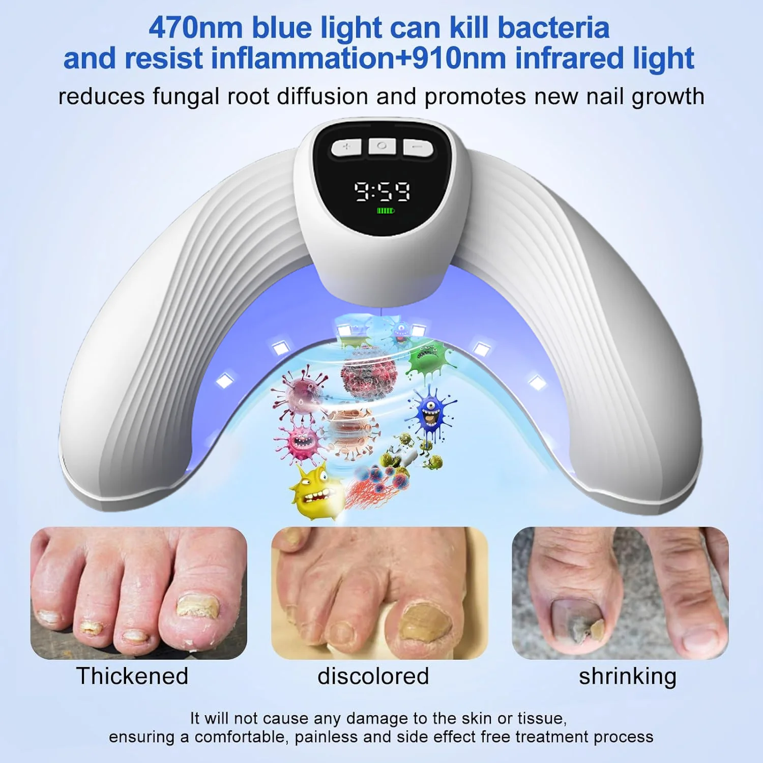 

Foot Care Nail Laser Fungus Device Multiple Toenails and fingernails Nail Repair Toenail for Damaged and Discolored Nails Home