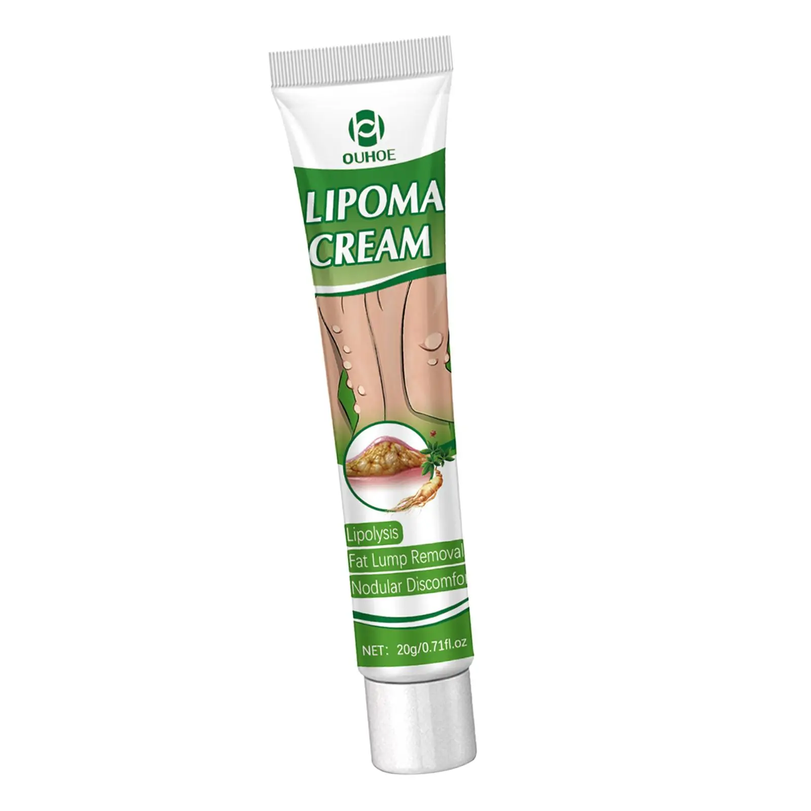 Crema per la rimozione del lipoma da 0,71 fl.oz Crema portatile per la cura della pelle Disagio nodulare Rimozione del lipoma