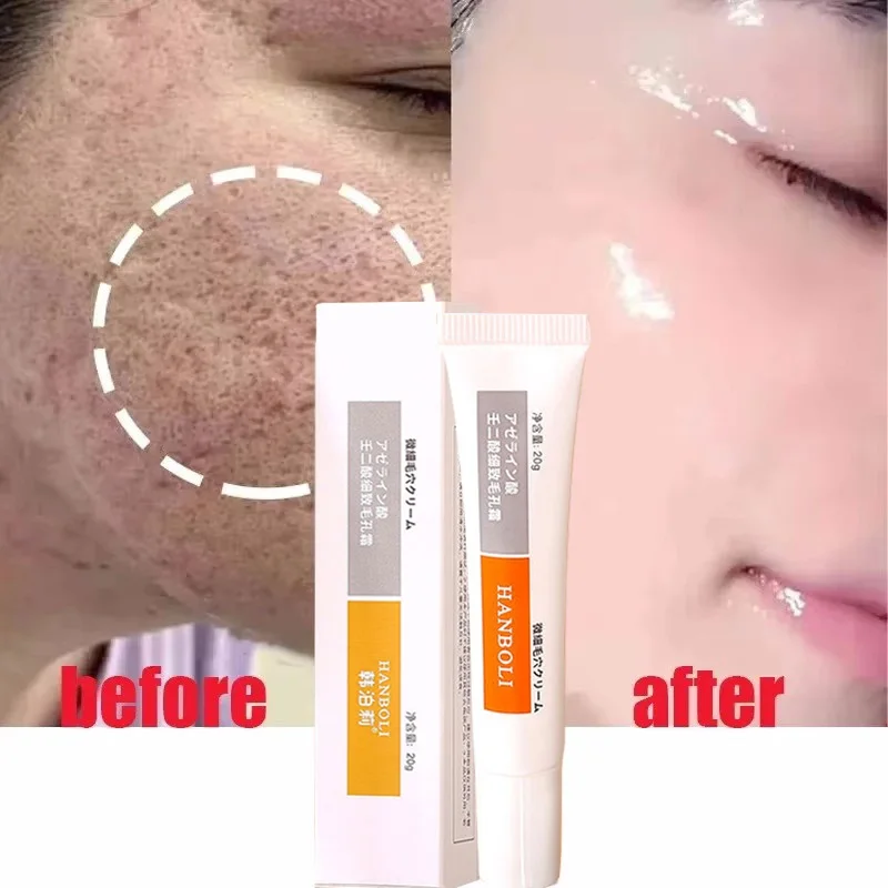 Crème de rétrécissement des pores à l'acide salicVAC, élimination rapide des grands pores, élimine les points noirs, resserre le visage, lisse la peau, produit de soin coréen