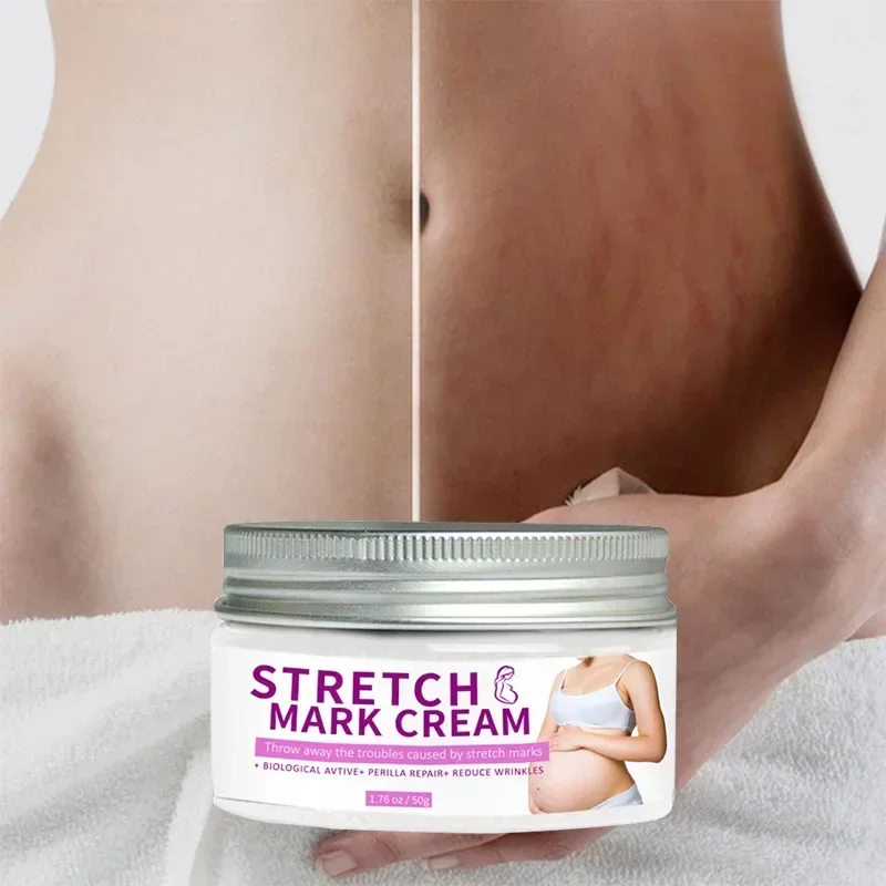 

Sdottor Removes Stretch Mark Cream To Remove Postpartum Obesity Pregnant Women Repair Anti-Aging Anti-Winkles Firming Body Skin