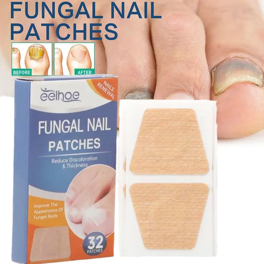 32/64PCS Foot Nail Repair Patch Grey Fungal Nail Thicken Soft Paronychia Infection Hand Nail Correction Sticker Ingrown Toenail