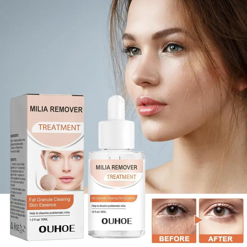 Milia Remover 30ml Dark Serum For Eyes Milia Remover Dissolve And Reduce Milia Brightens Smooths Skin