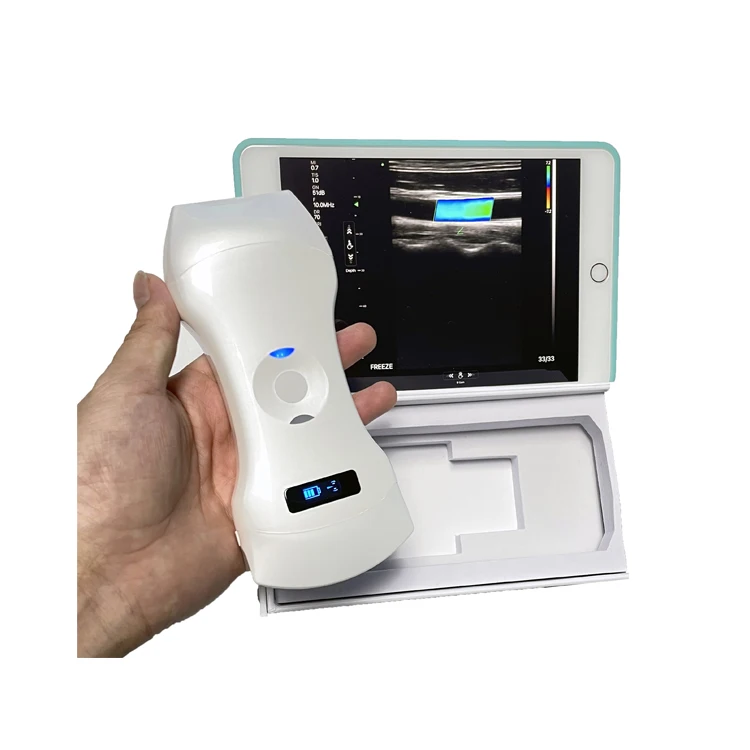 

192 Element Phased Array Cardiac, Linear & Convex 3 in 1 Color Doppler Ultrasound Scanner Portable