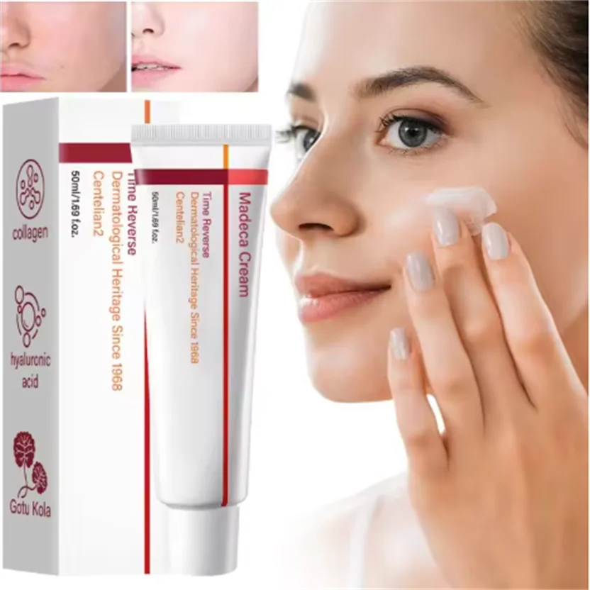 

Mild Niacinamide Lightening Melasma Cream Effectively Fade Melanin Bleaching Cream Remove Dark Pigment Moisturizing Skin Care