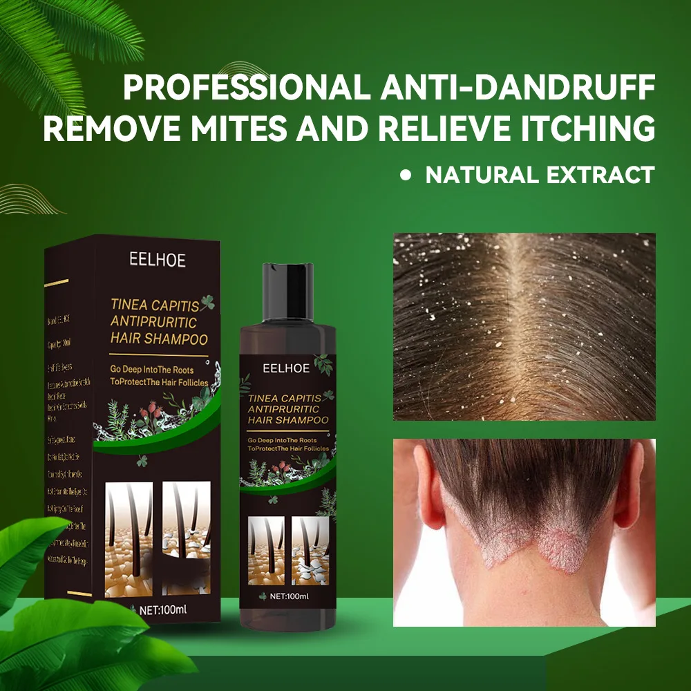 100 ml Eelhoe Shampoo Anti-Juckreiz-Shampoo Anti-Schuppen Anti-Juckreiz-Shampoo Anti-Haarausfall Erfrischendes Shampoo Profissional