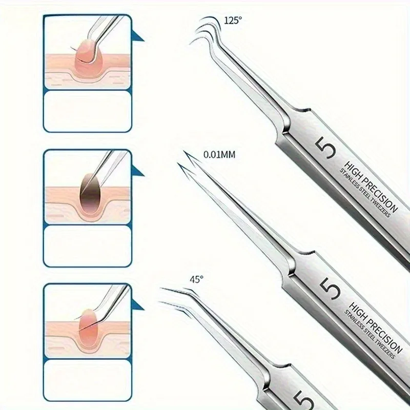 Mee-eter Clip Puistjes Pincet Mee-eter Remover Roestvrijstalen Mobiele Clip Schoonheidsproduct Acne Naald Huidreinigingsgereedschap