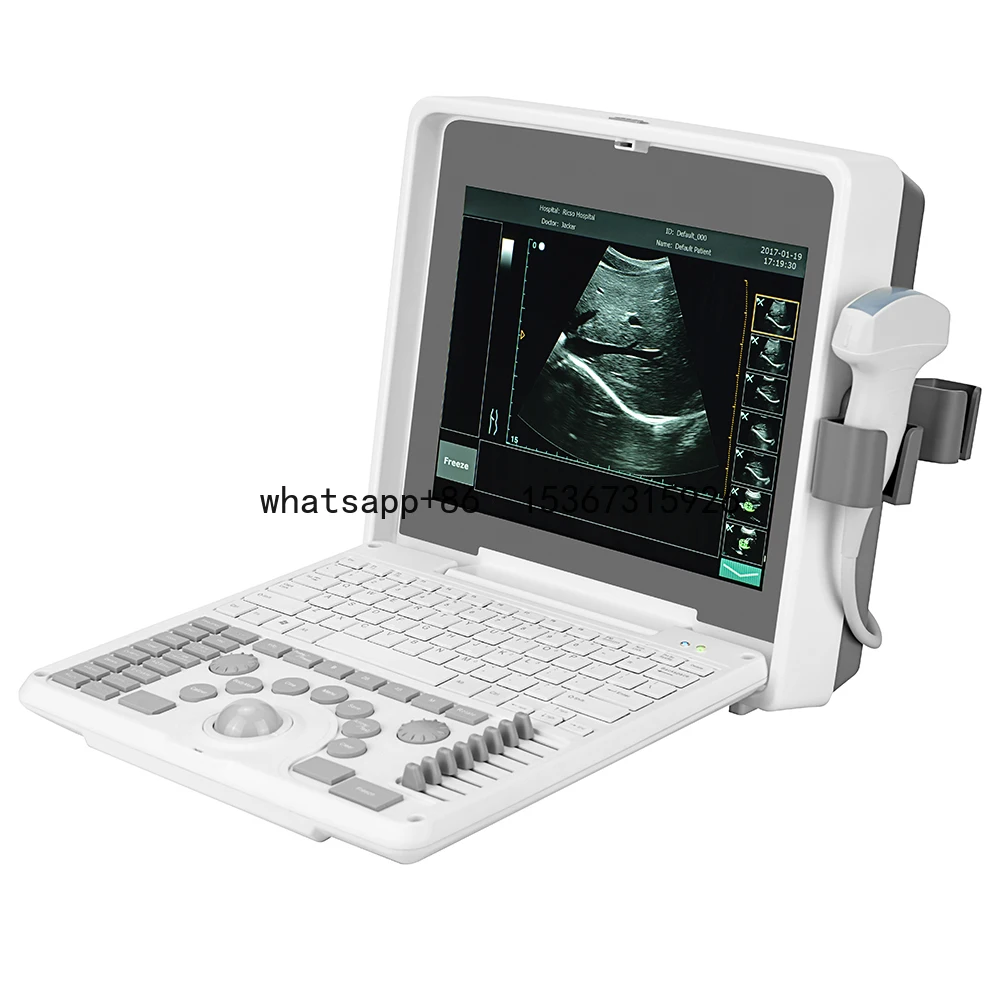 Medical Animal Veterinary Instrument Ultrasound Machine Price For Vet Ultrasound Pregnancy Scanner