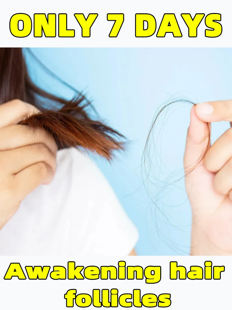 شحن مجاني ، أداة توزيع فروة الرأس الصغيرة مدلك الرأس فرشاة الكرة الدوارة لنمو الشعر السائل قضيب تدليك مشط الجمع