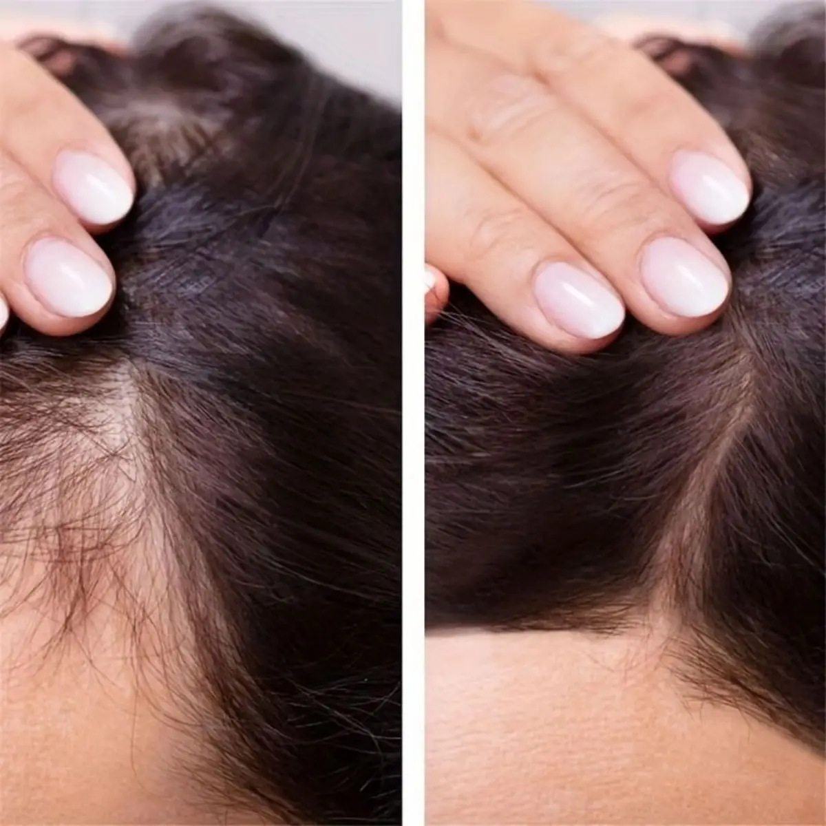 Crescimento do cabelo para homens ferramenta de crescimento de óleo essencial reparação do cabelo proteção furcation cuidados com o crescimento do