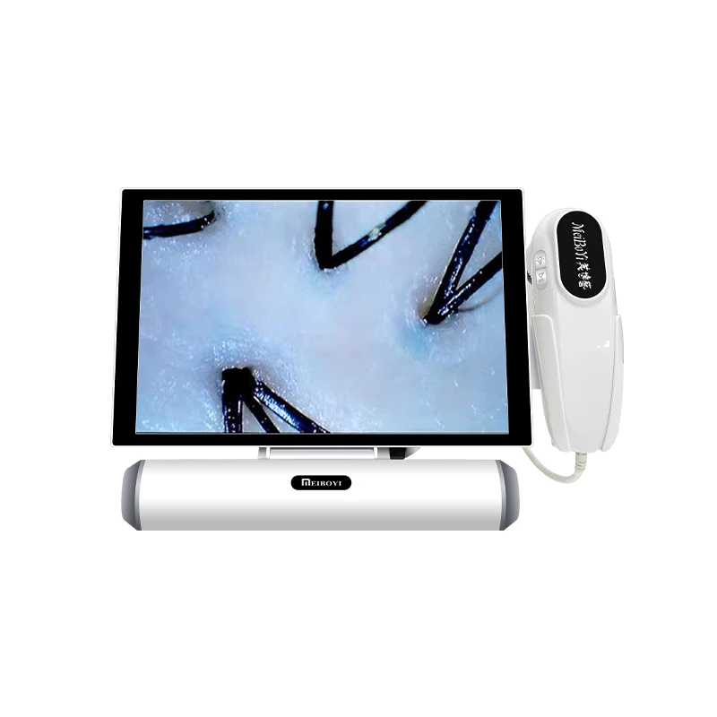

Meiboyi Scalp Scanner Intelligent Detection Hair And / Skin And Hair Detector