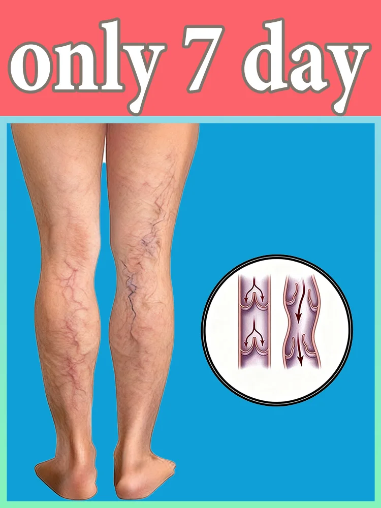 

Популярные товары в 2025 году: Массажные инструменты, средства для облегчения болит ног.