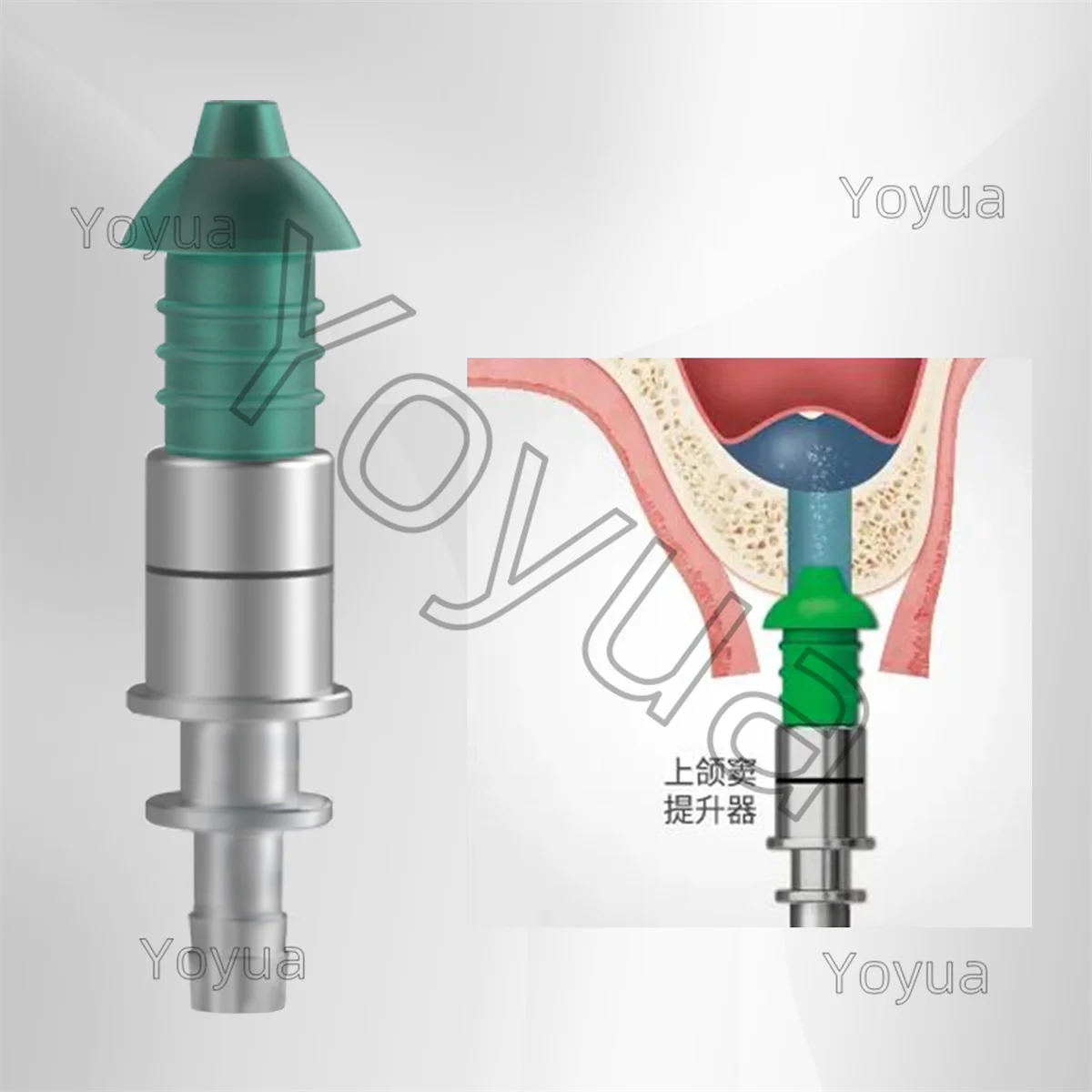 1 مجموعة زراعة الأسنان الفكري الجيوب الأنفية رفع أداة صندوق كريستال نهج الجيوب الأنفية عدة طبيب الأسنان زرع الأدوات الجراحية أدوات #6