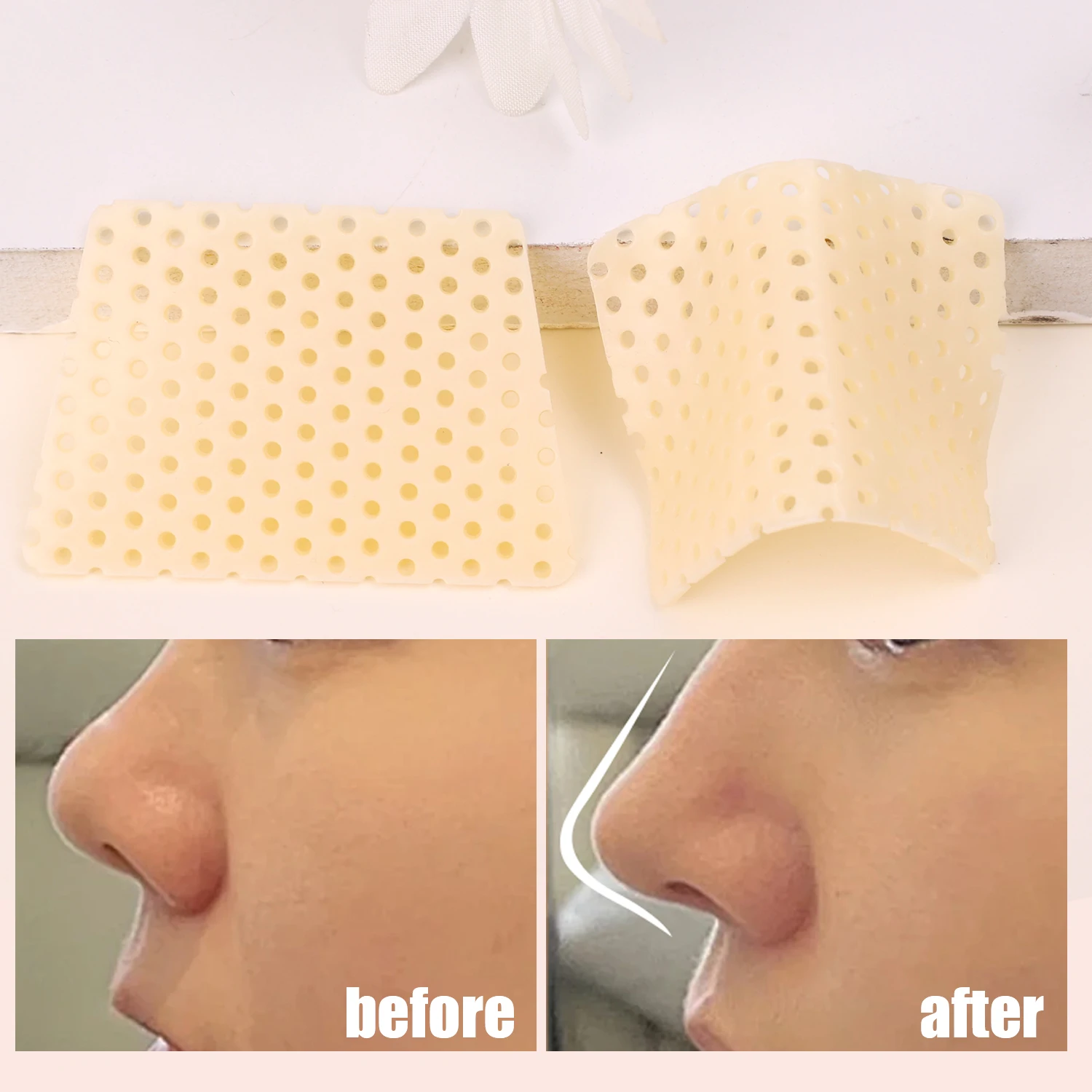 自己整形鼻副子低温熱可塑性鼻整形粘着テープ骨折副子外部サポート固定を提供