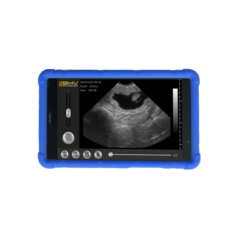 Full digital beam forming portable veterinary ultrasound veterinary scanner tools and equipment