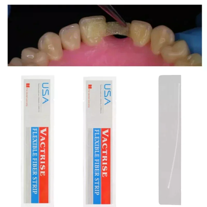 1/2/5 Peças Material Odontológico Tira de Fibra Flexível de Vidro para Fixação de Dentes Soltos, Tiras de Ligação Fotopolimerizável, Retentores Ortodônticos
