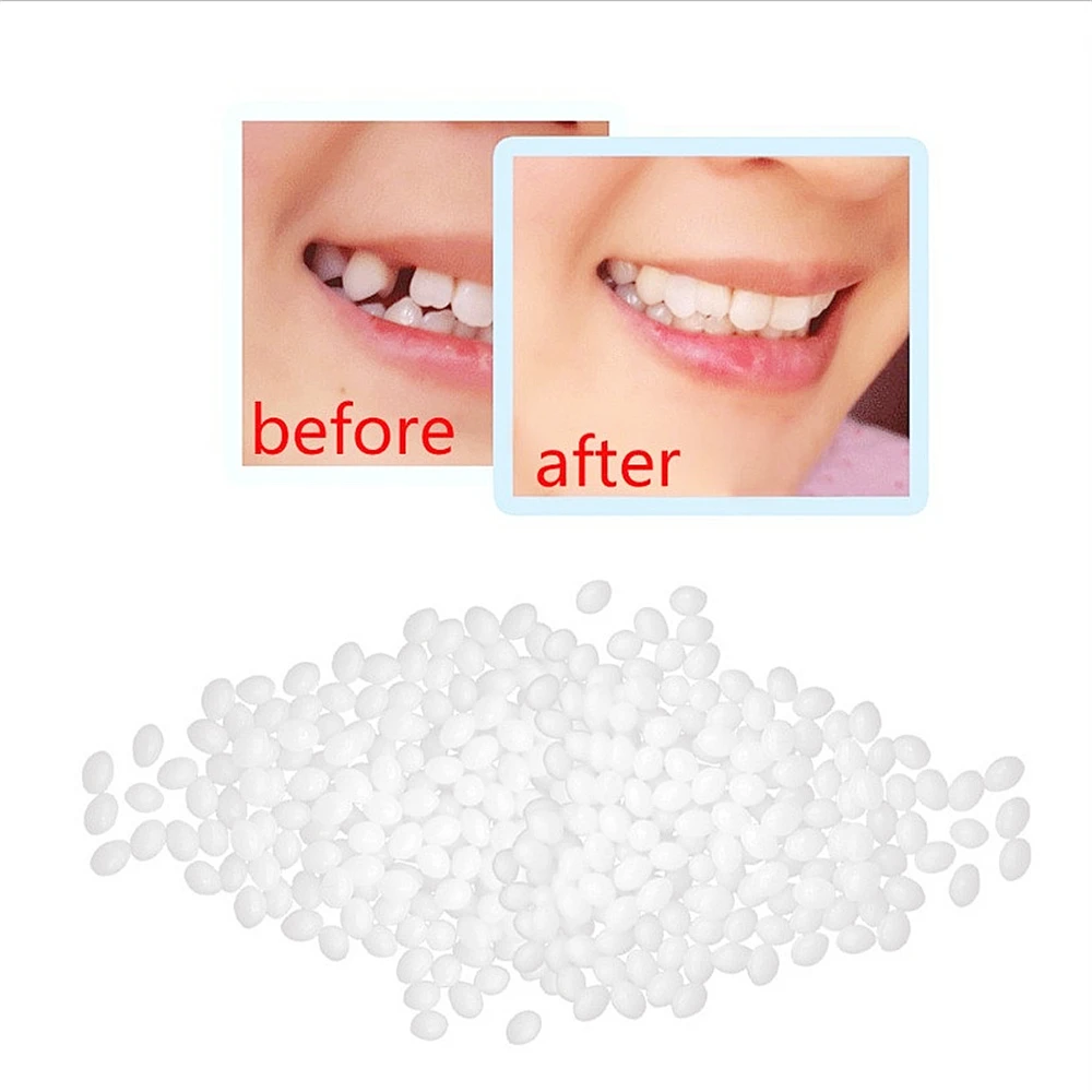 Kit de reparación de dientes, cuentas térmicas para relleno, fijación de dientes faltantes y rotos, adhesivo para dentadura postiza, 10g por bolsa