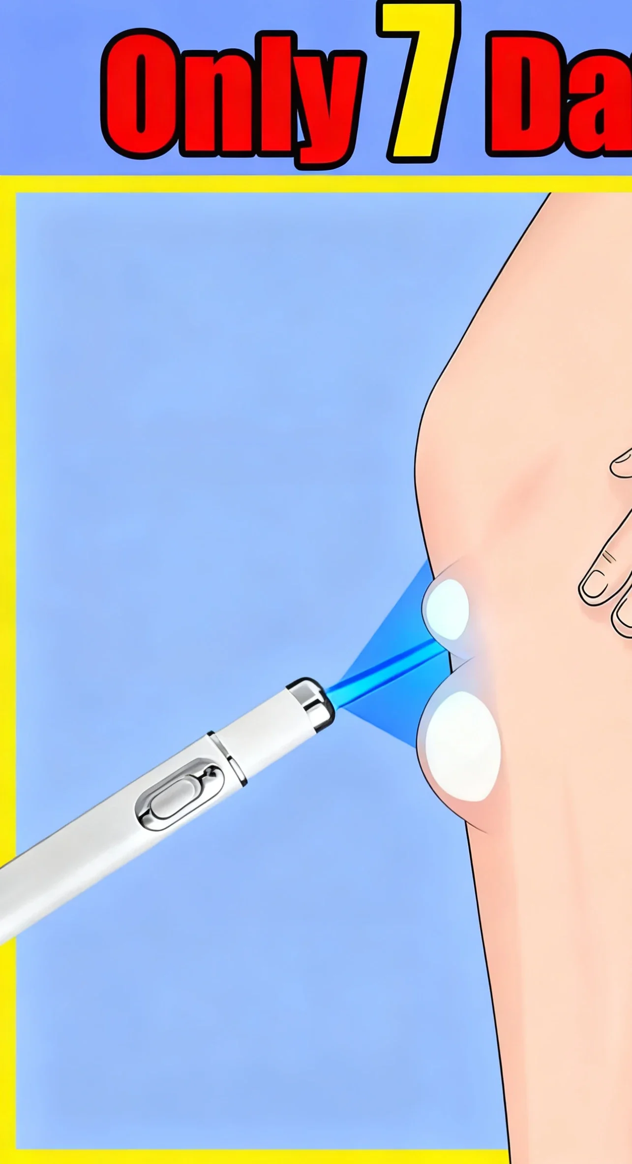 

Professional Blue Laser Skin Care Pen, for Reducing The Appearance of Blemishes and Promoting a Radiant Glow.