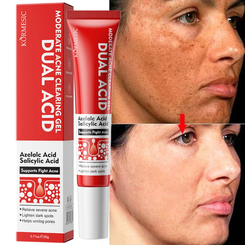 Niacinamide Whitening Freckle Cream Lightening Melasma Face Cream Brighten Skin Repair Melanin Dark Spots Bleaching Skin Care